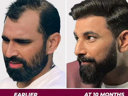 🌿 Jamalgota Ayurvedic Hair Growth Powder Buy 1 Get 1 Free🌿